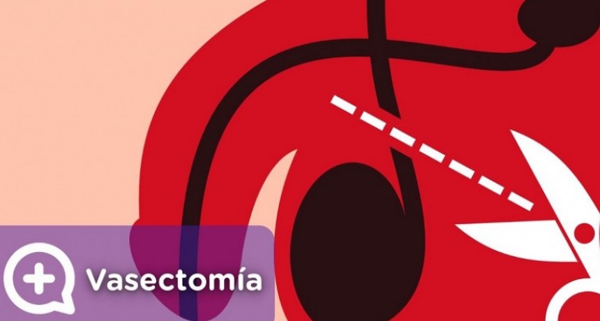 El acceso a la vasectomía garantizado en Catamarca