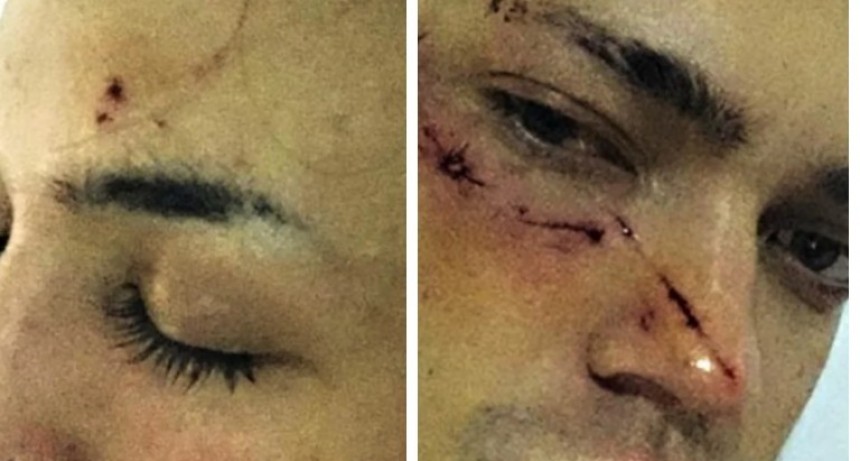 Jóvenes agredidos en nuevo ataque homofóbico en Palermo: Putos de mierd...!