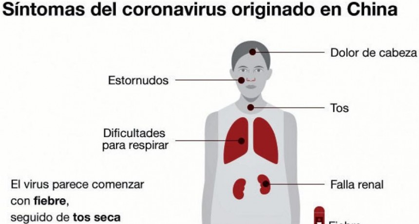 Coronavirus: cuáles son los síntomas y otras 3 preguntas clave sobre el virus