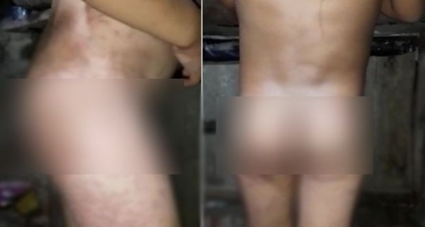 Mujer torturaba a sus hijos haciéndolos sentar desnudos sobre un hormiguero