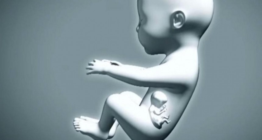 Colombia: una beba nació “embarazada” de su hermano gemelo y causó estupor en el mundo científico