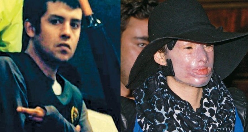 5 años y 26 operaciones: La historia de la colombiana víctima de un fulminante ataque con ácido