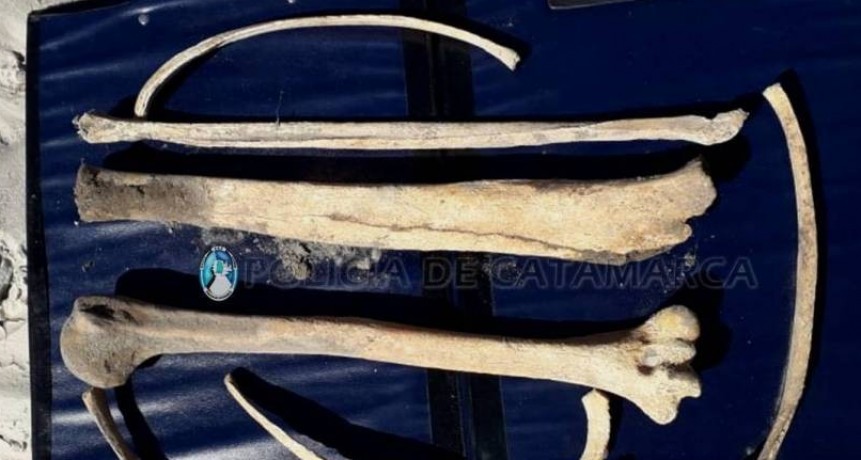 Encuentran restos óseos en Santa María