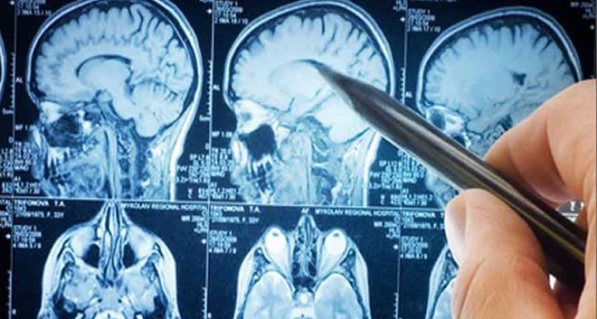 Crearon un “interruptor” cerebral para reducir los ataques de epilepsia