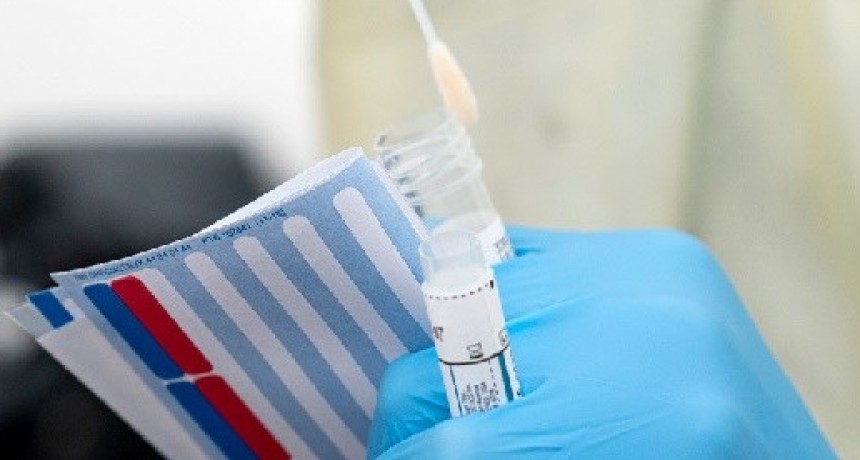 Identifican en Cataluña un fármaco que bloquea los efectos del coronavirus