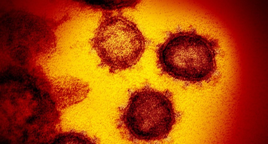  Desde el cerebro hasta los dedos de los pies: así puede extenderse y matar el coronavirus 