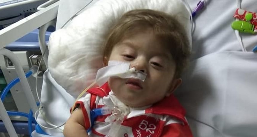 Falleció Jairo, el bebé catamarqueño que tenía una compleja enfermedad