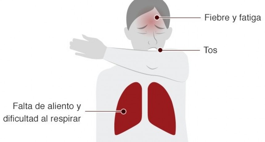 Nuevo récord de contagios de coronavirus en Argentina: 258 casos nuevos para llegar a 6.034