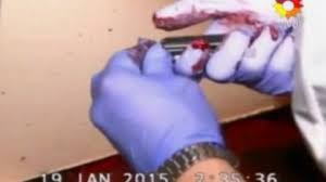 Irregularidades en el Peritaje donde Limpiaron el Arma con Papel higi&eacute;nico