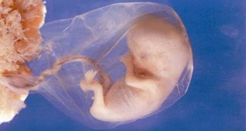 Respuesta a Lanata por sus declaraciones sobre el Aborto