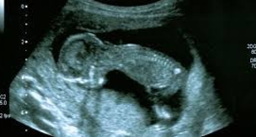 Buscan que sea obligatoria la realización de ecografías fetales