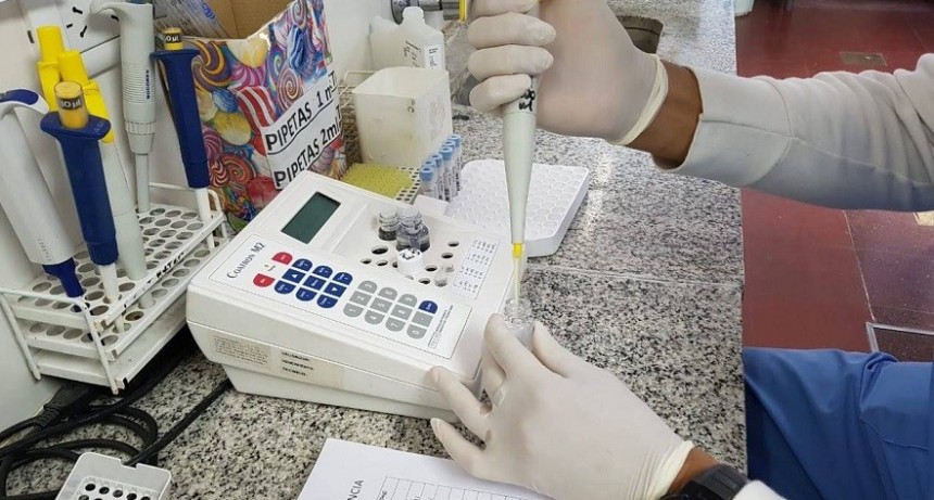 Implementan el sistema BD Vacutainer para la toma de muestra de Sangre, en laboratorios del Sector público