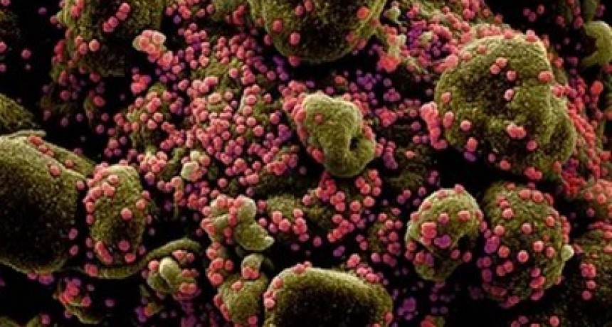 Encontraron 47 medicamentos ya conocidos que pueden combatir el Covid-19