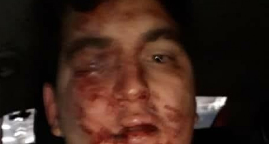 Lo molieron a golpes 