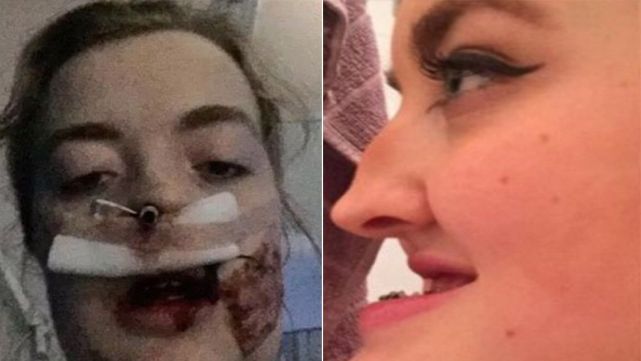 Le dec&iacute;an "bulldog" por su cara, se oper&oacute; y qued&oacute; bell&iacute;sima