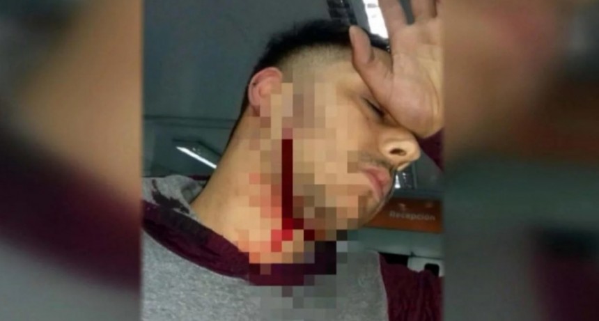 Violento ataque a un colectivero: le cortaron el cuello para robarle