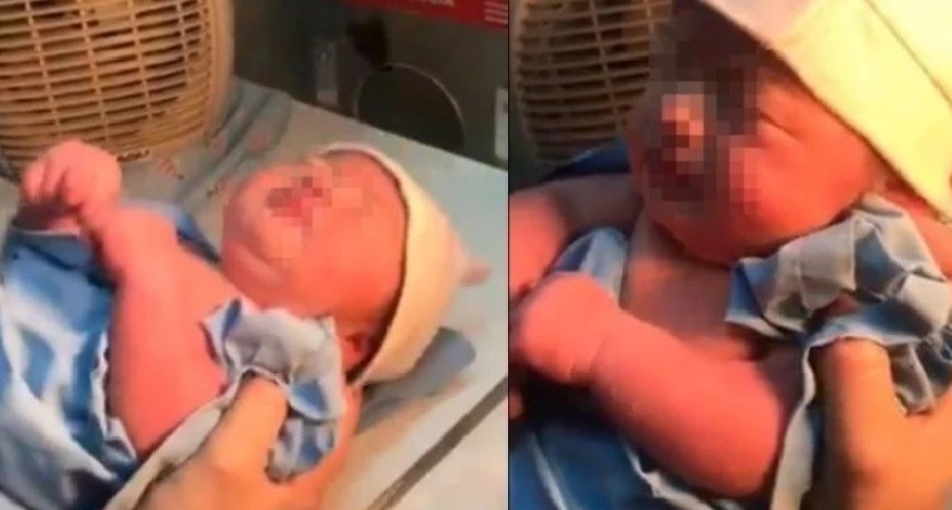 Video: encontraron a una beba abandonada en una bolsa de residuos