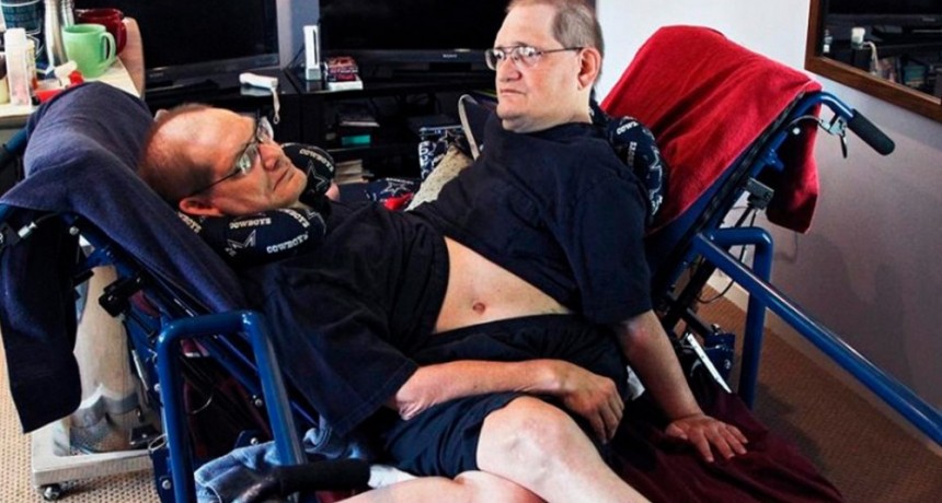  Los hermanos siameses más longevos del mundo mueren a los 68 años 