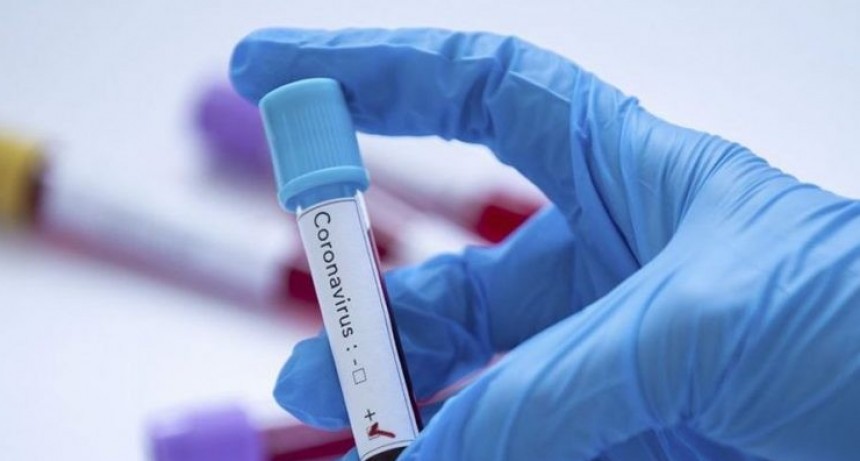 Coronavirus en la Argentina: reportaron 29 nuevas muertes y el total de víctimas llegó a 2.617