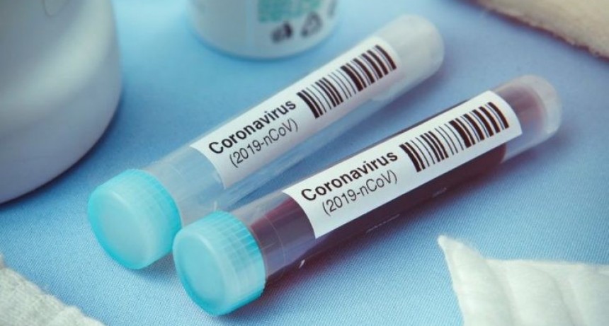 Coronavirus en la Argentina: confirmaron 17 nuevas muertes y las víctimas fatales son 2.956