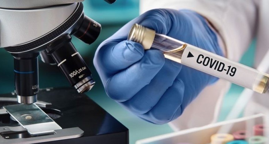 Coronavirus en la Argentina: confirmaron 23 nuevas muertes y el total de víctimas llegó a 3.082