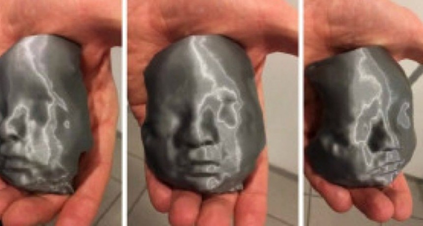 Papas Ciegos Pudieron conocer a su beb&eacute; antes de nacer