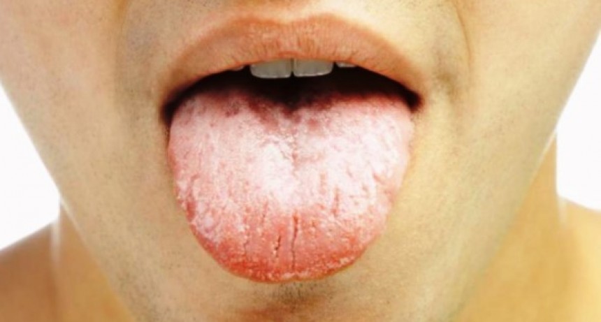 Aumentaron los casos de cáncer bucal por la práctica de sexo oral