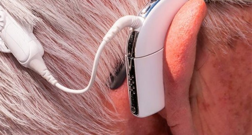 Rev&eacute;s para OSEP : La Corte fall&oacute; y obliga a la obra social a cubrir un implante auditivo
