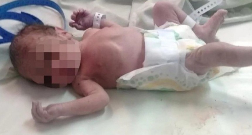 Logran reanimar a un beb&eacute; abandonado en la basura