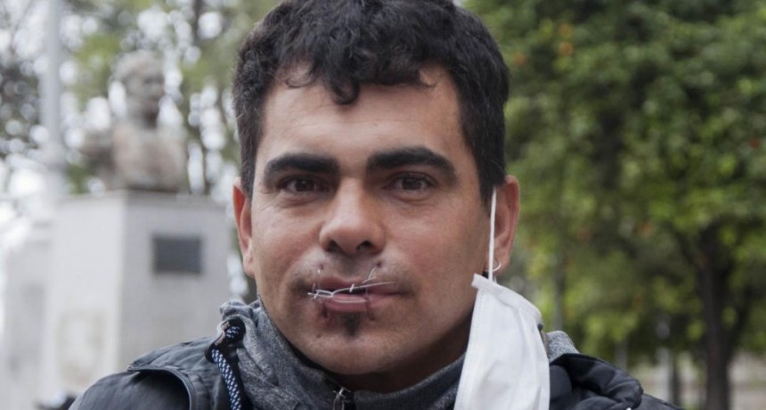  Inició una huelga de hambre cosiendo su boca y encadenándose frente a Casa de Gobierno 