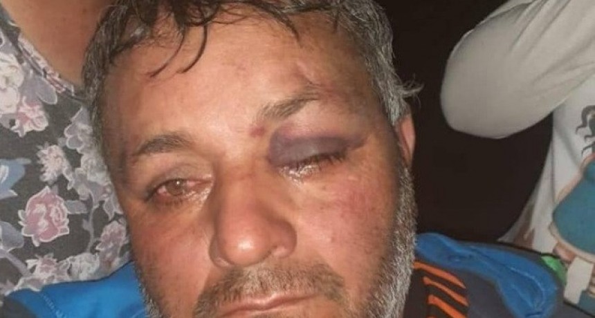 Denunció que fue brutalmente golpeado por policías dentro del patrullero