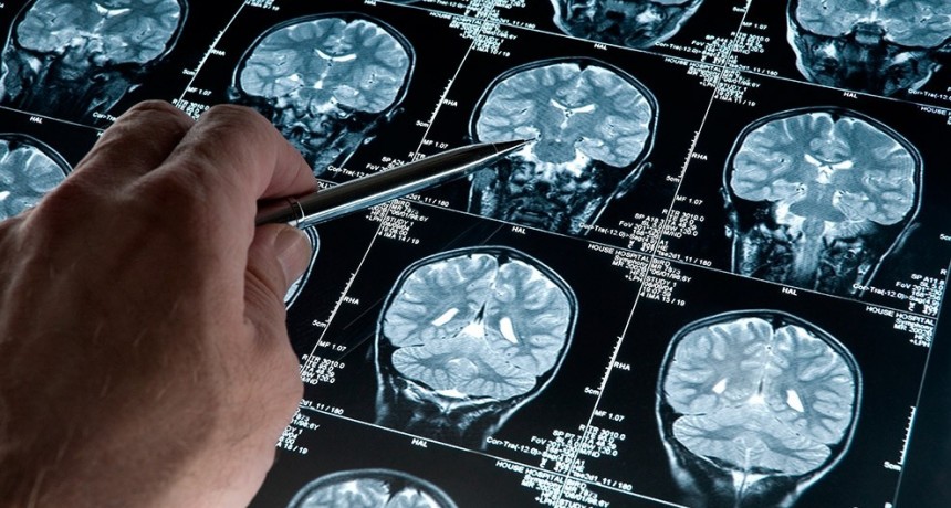 Logran retrasar la aparición del Alzheimer en ratones gracias a un anticoagulante oral