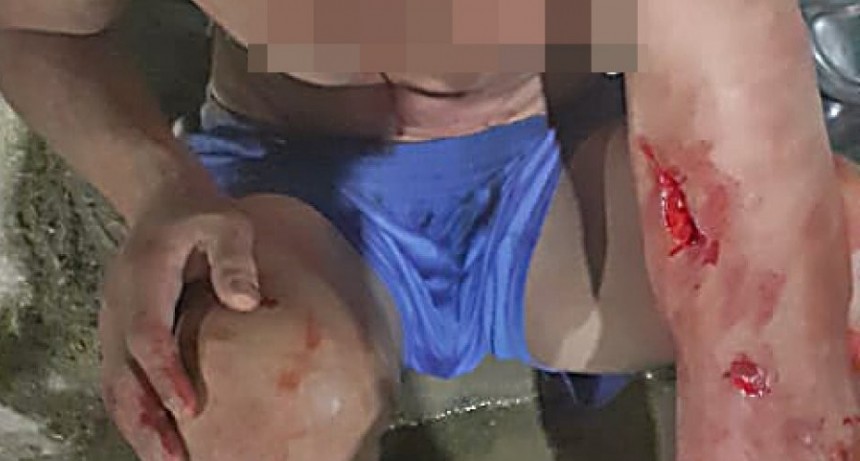 Dia de la Madre: domingo signado por la violencia, personas apuñaladas, grescas callejeras y violencia familiar