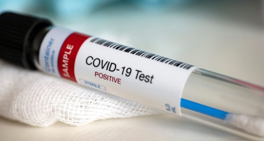 Aguas de Catamarca informa que en las últimas horas se detectaron dos casos positivos COVID-19 en la empresa