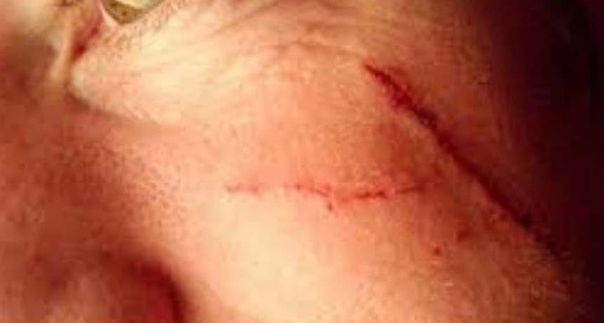 Proh&iacute;ben a mujer acercarse a su ex, m&eacute;dico, a quien le desfigur&oacute; la cara con las u&ntilde;as