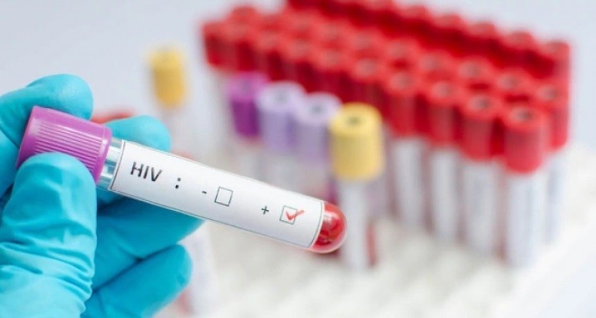 Un estudio franc&eacute;s descubri&oacute; una f&oacute;rmula que permite eliminar el virus del VIH