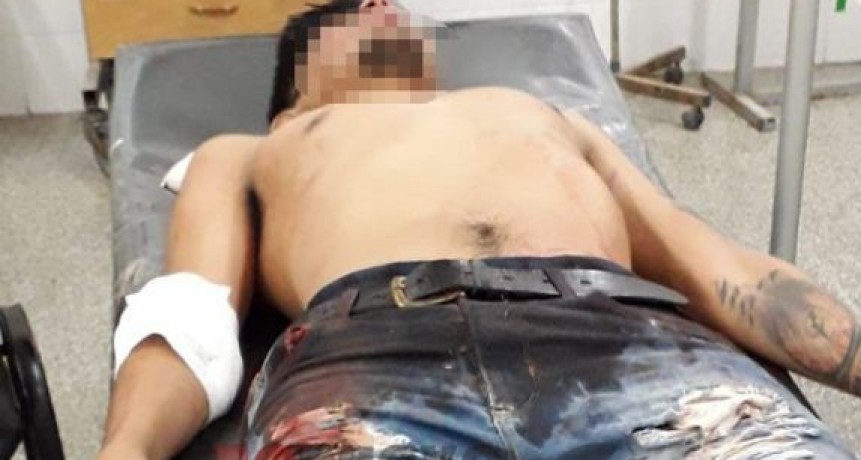 Cinco jóvenes hospitalizados con graves heridas luego de tomar una curva a 150 k/h