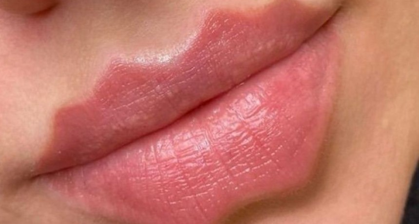 Peligrosa moda viral: los labios del diablo