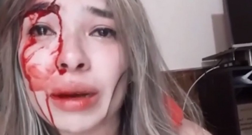 Se filmó ensangrentada para denunciar que su pareja la golpeó salvajemente