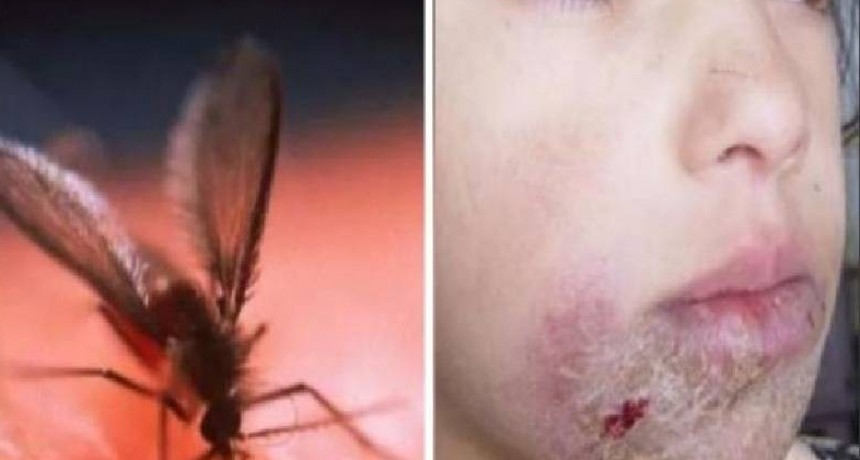 Alerta en Salta por una extraña enfermedad que transmite una mosca