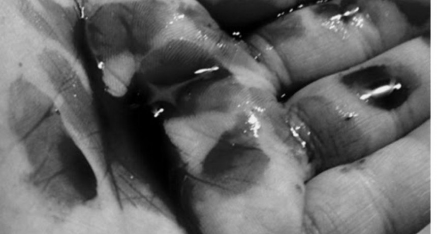 Navidad con lesionados, heridos con armas blancas y robos